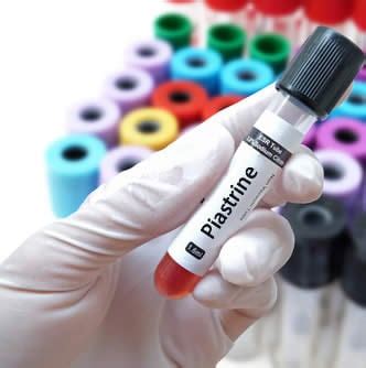 pdw piastrine|analisi sangue pdw.